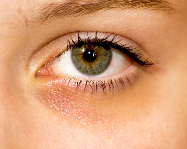 10 сигналов нашего тела, к которым нужно отнестись серьезно