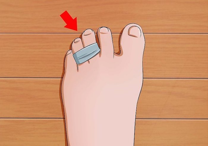 Секреты от моделей: разносить обувь без мозолей