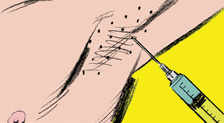 Как избавиться от повышенной потливости