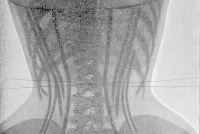 7 жертв, на которые шли женщины прошлого ради красоты