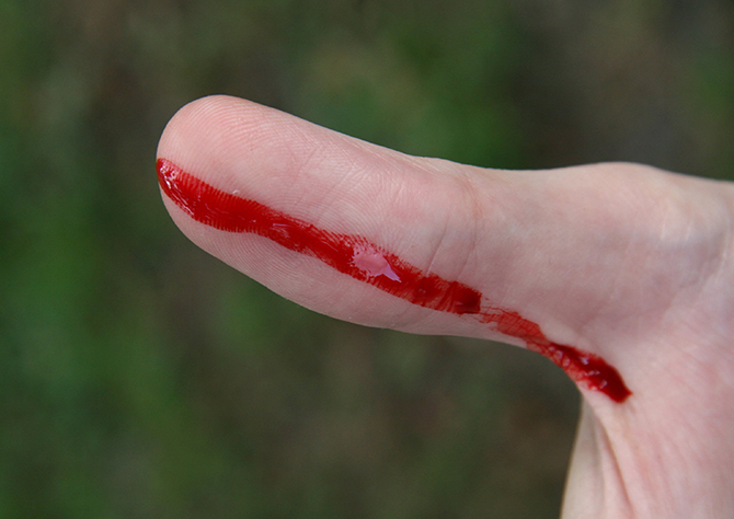 Как наш организм подсказывает нам сигналы о болезни Как наш организм подсказывает нам сигналы о болезни