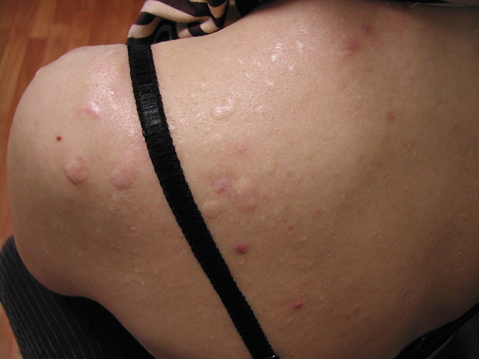 Как наш организм подсказывает нам сигналы о болезни Как наш организм подсказывает нам сигналы о болезни