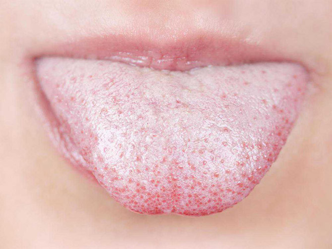 Как наш организм подсказывает нам сигналы о болезни Как наш организм подсказывает нам сигналы о болезни