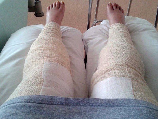 Жуткая реакция женщины на интимную депиляцию