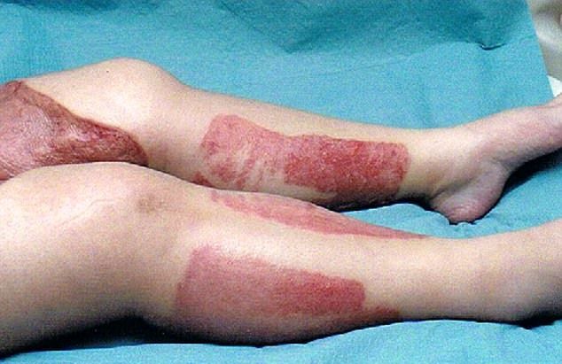 Жуткая реакция женщины на интимную депиляцию