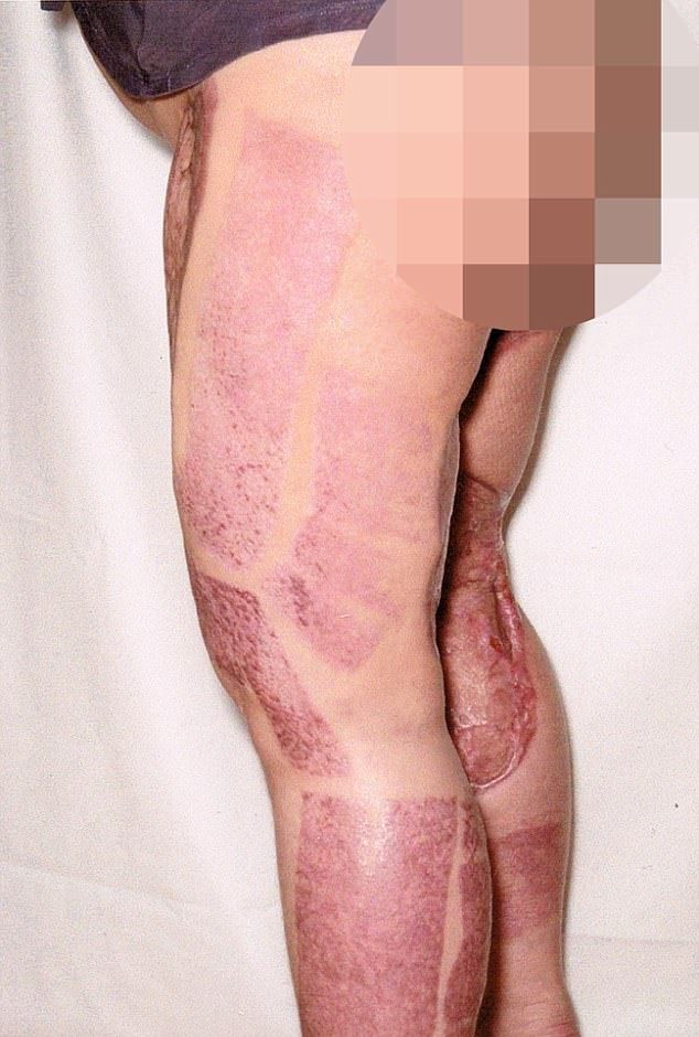 Жуткая реакция женщины на интимную депиляцию