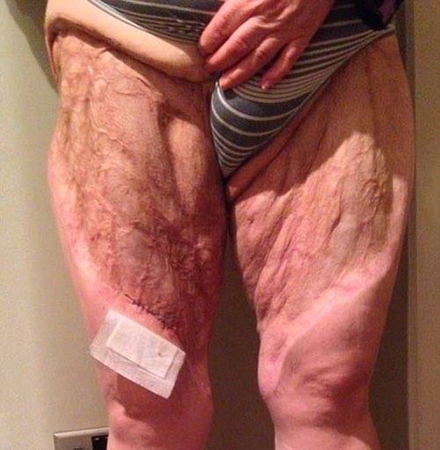 Жуткая реакция женщины на интимную депиляцию