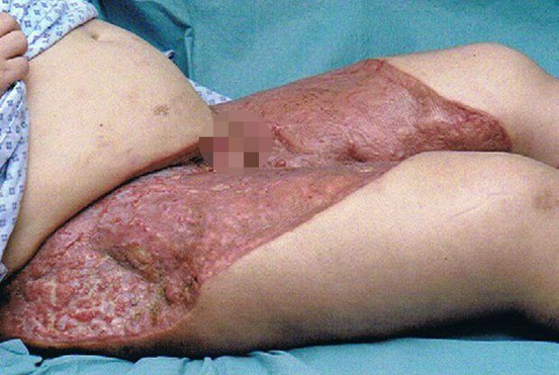 Жуткая реакция женщины на интимную депиляцию