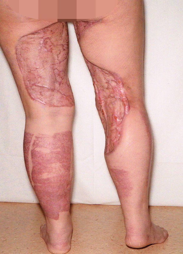 Жуткая реакция женщины на интимную депиляцию