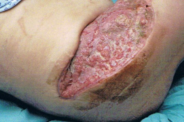 Жуткая реакция женщины на интимную депиляцию