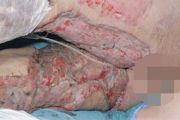 Жуткая реакция женщины на интимную депиляцию