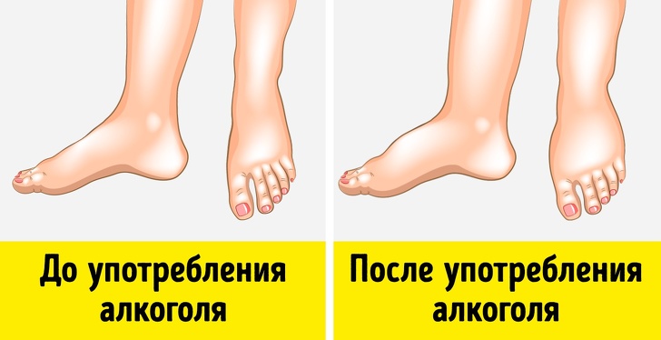 9 признаков алкогольной непереносимости, о которых многие не подозревают