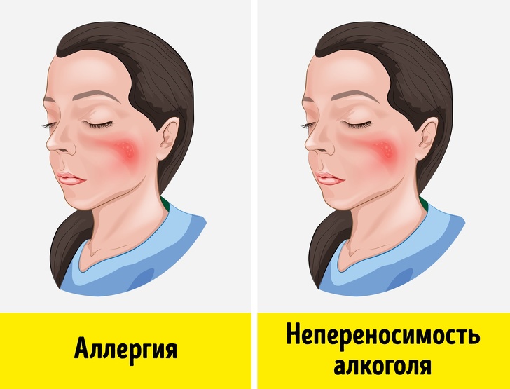 9 признаков алкогольной непереносимости, о которых многие не подозревают