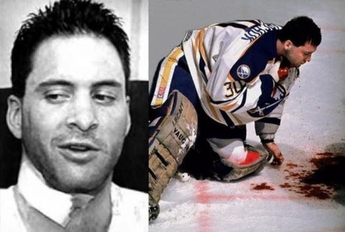 Спортсмены, жизнь которых сломали страшные травмы