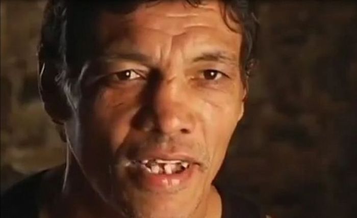 Спортсмены, жизнь которых сломали страшные травмы