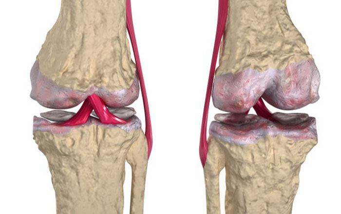 Недуги, которые можно вылечить марихуаной