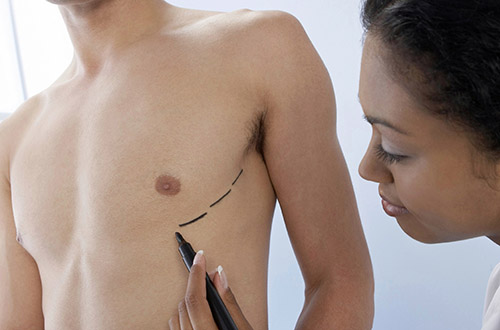 10 самых экзотических пластических операций