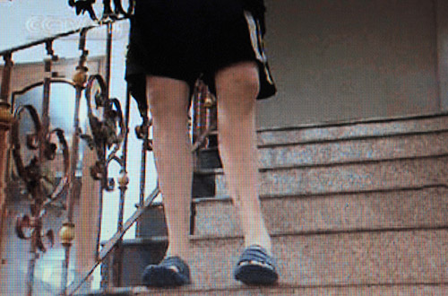 10 самых экзотических пластических операций