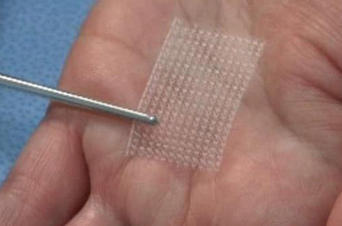 10 самых экзотических пластических операций