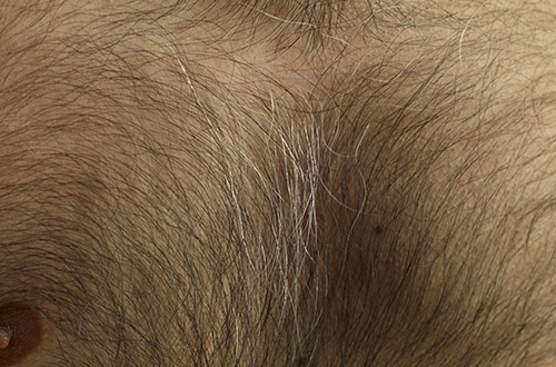 10 самых экзотических пластических операций