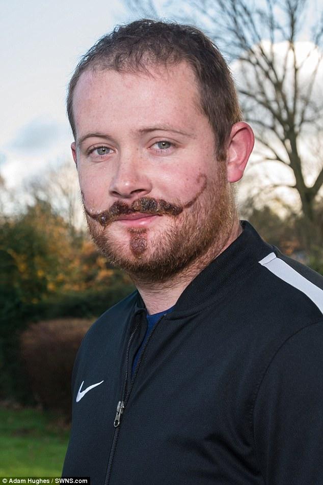 Временная тату оставила сильные шрамы на лице парня