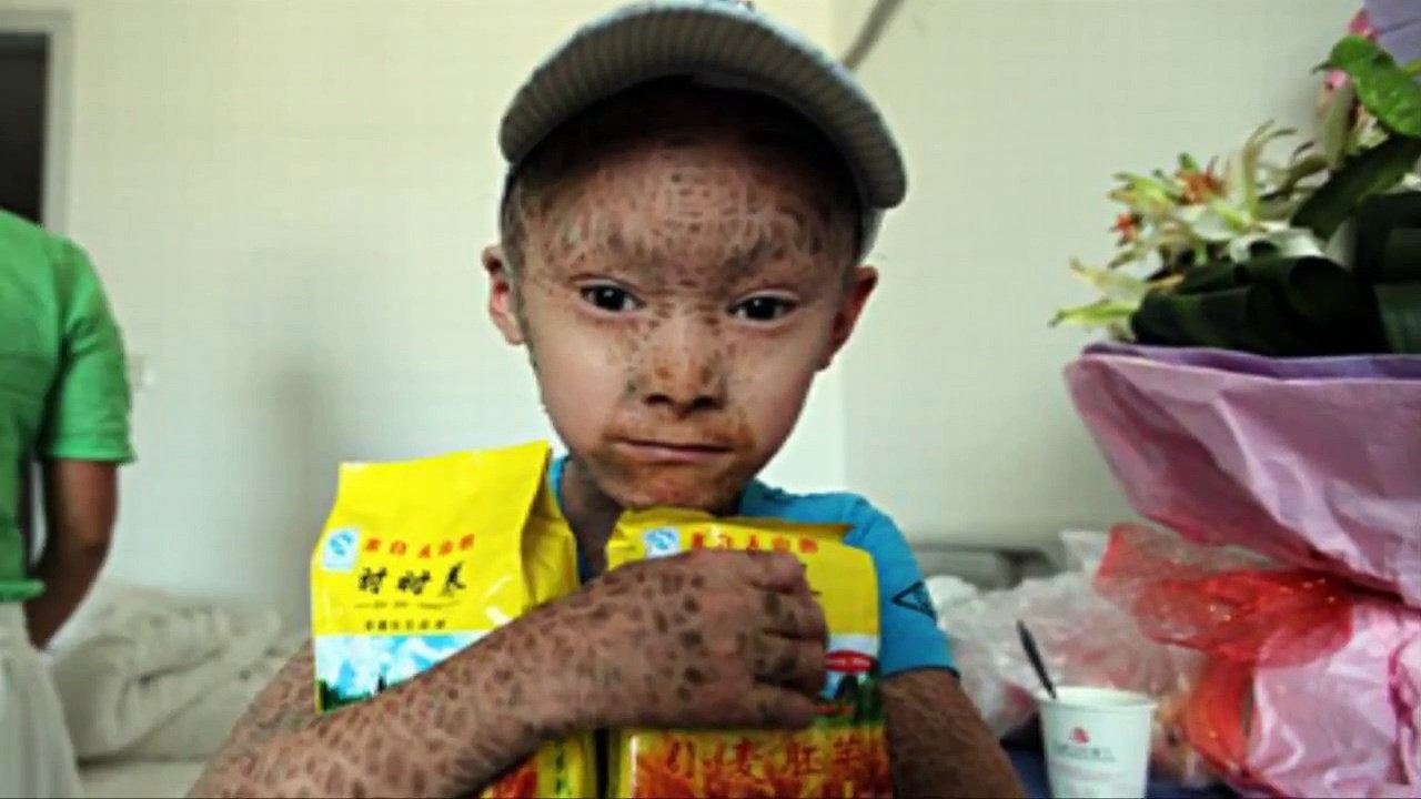 Недетские испытания, выпавшие на детскую долю, или несколько поразительных ребят, которые шокировали весь мир. Часть 2