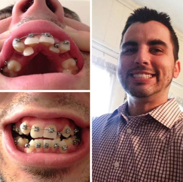 Интересные снимки в формате "до и после"