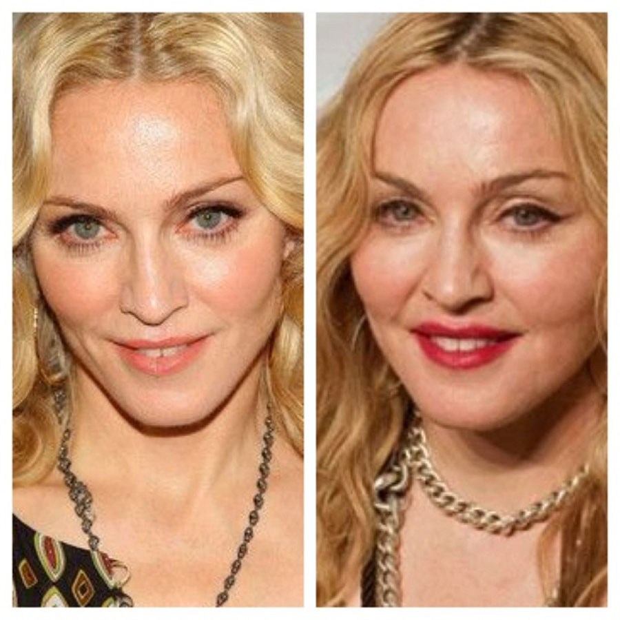 Знаменитости, которых изменил ботокс Знаменитости, которых изменил ботокс