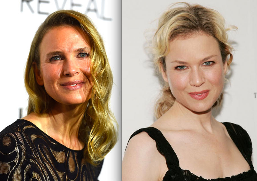 Знаменитости, которых изменил ботокс Знаменитости, которых изменил ботокс