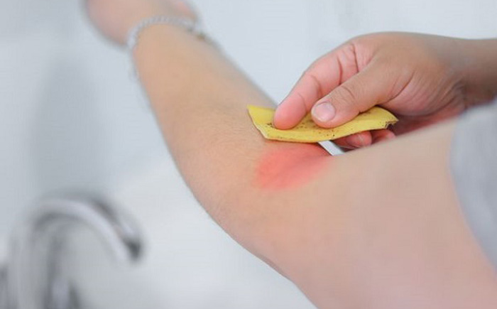 15 невероятных способов применения банановой кожуры, о которых вы точно не знали