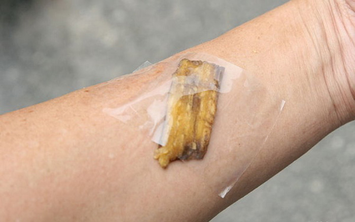 15 невероятных способов применения банановой кожуры, о которых вы точно не знали