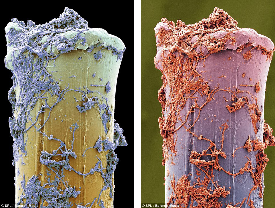 Микромир у нас во рту