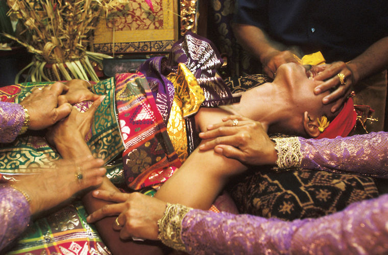 Страны, в которых увечья считаются красивыми