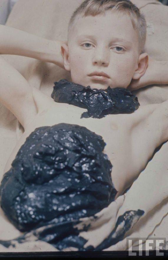 Советская медицина на страницах журнала LIFE Советская медицина на страницах журнала LIFE