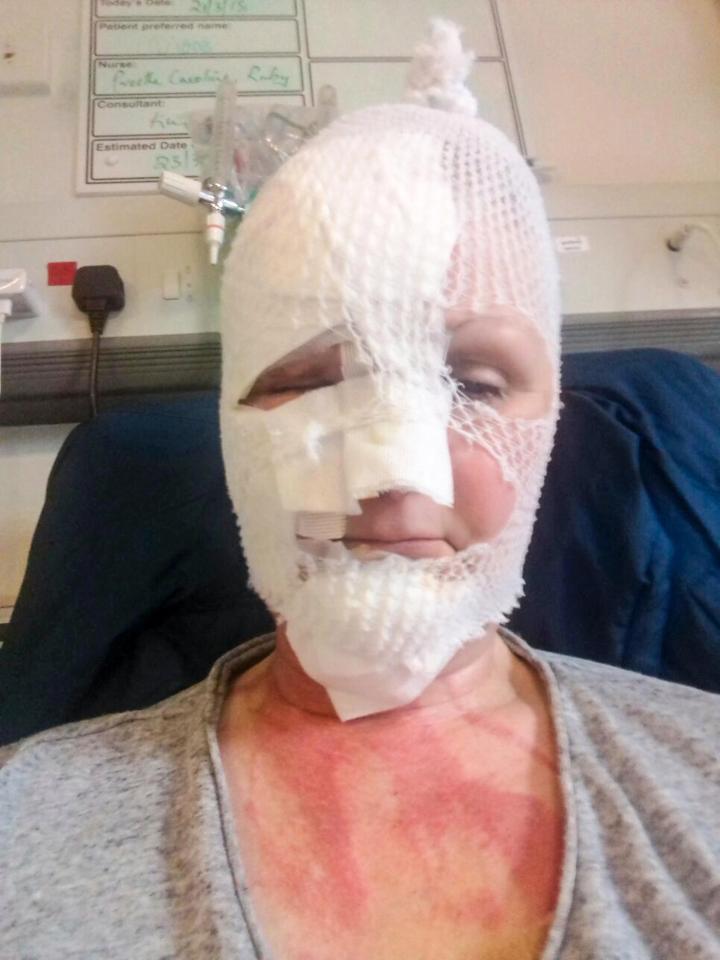 Чем опасно приготовление яиц в скорлупе в микроволновке