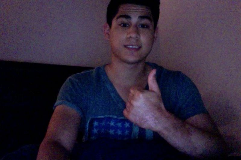 Сварил руку во фритюрнице (17 фото)