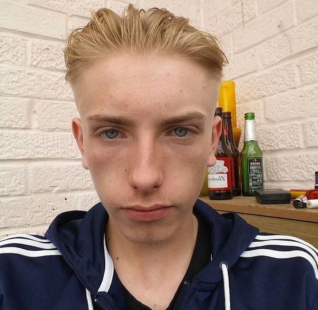 Даже такой маленький песик, как джек-рассел-терьер, может изрядно изуродовать лицо