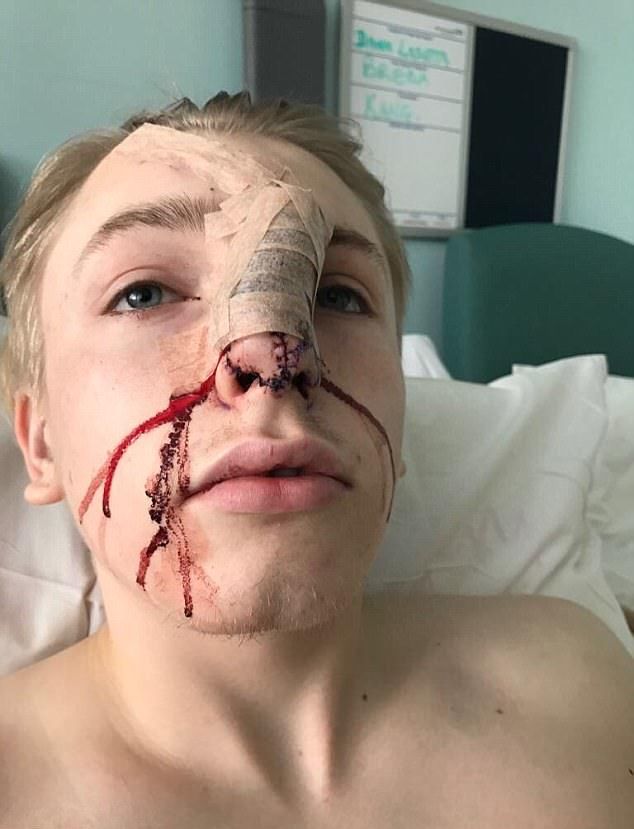 Даже такой маленький песик, как джек-рассел-терьер, может изрядно изуродовать лицо