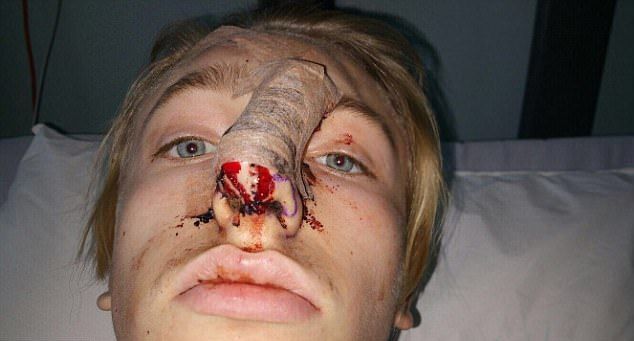 Даже такой маленький песик, как джек-рассел-терьер, может изрядно изуродовать лицо