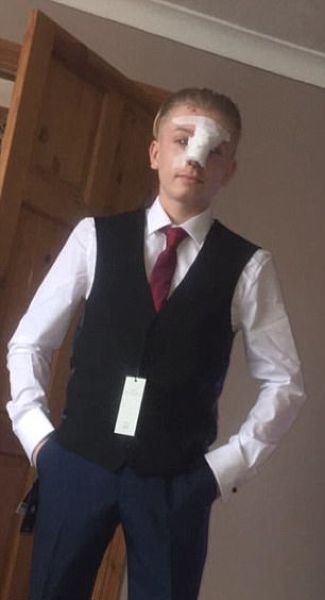 Даже такой маленький песик, как джек-рассел-терьер, может изрядно изуродовать лицо