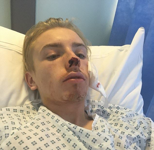 Даже такой маленький песик, как джек-рассел-терьер, может изрядно изуродовать лицо