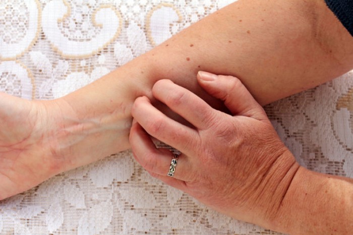 10 странных медицинских практик из прошлого, которые, к счастью, были заброшены