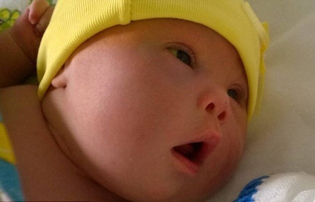 Между женой и сыном с синдромом Дауна мужчина выбрал ребенка