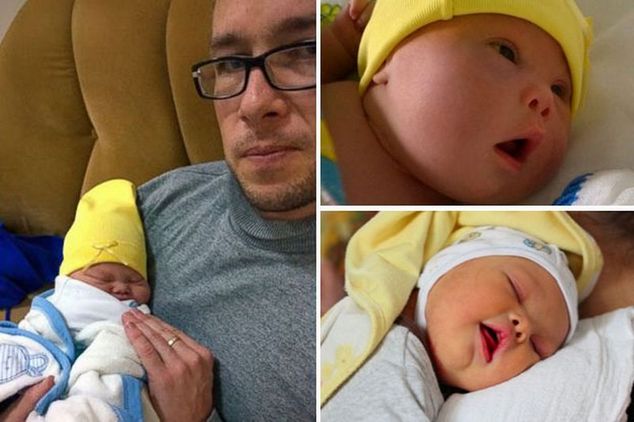 Между женой и сыном с синдромом Дауна мужчина выбрал ребенка