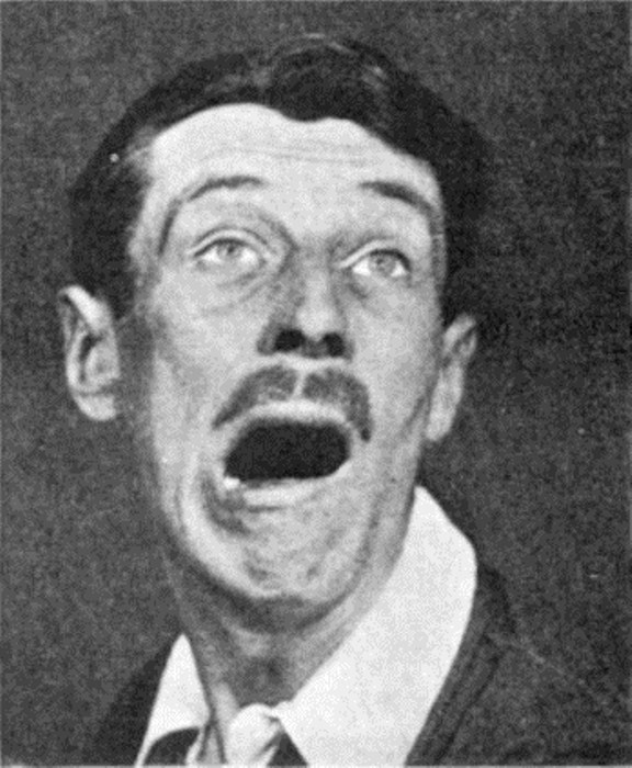 Сонная болезнь – таинственный недуг в истории медицины Сонная болезнь – таинственный недуг в истории медицины