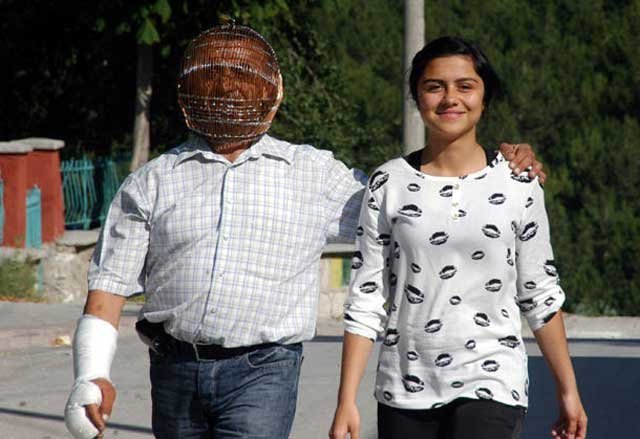 Житель Турции закрыл голову в клетке, чтобы избавиться от никотиновой зависимости