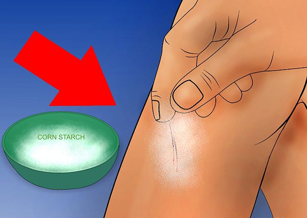 Первая помощь: как быстро остановить кровь?