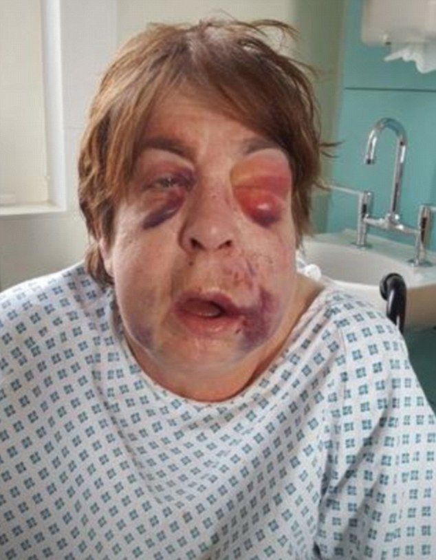 Старушке изрядно досталось от дилеров за сына, который набрал травки на сотню фунтов