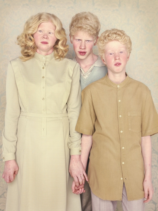 Остался с альбиносом