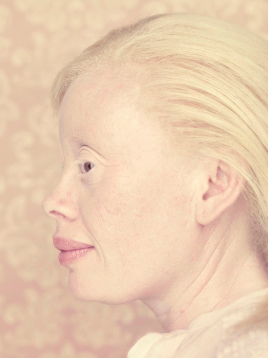 Остался с альбиносом